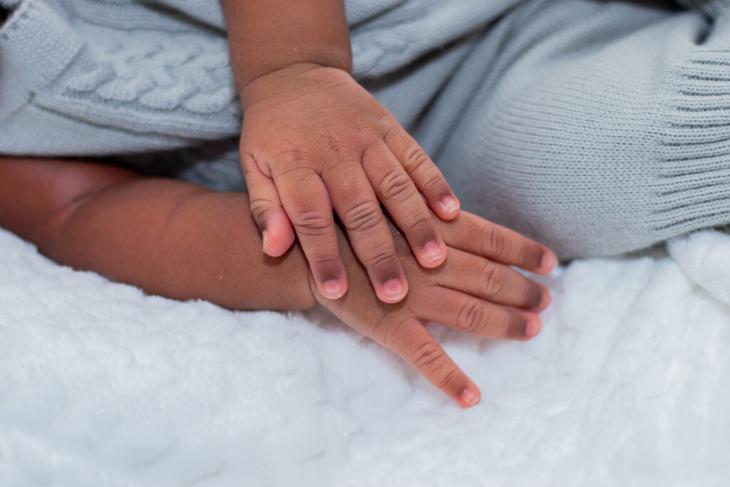 Se você tem um filho com Zika vírus, veja como receber a pensão do INSS.