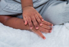 Se você tem um filho com Zika vírus, veja como receber a pensão do INSS.